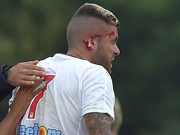 Berita Sepak Bola: Seram, Mantan Bintang AC Milan Alami Cedera Mengerikan di Laga Debutnya