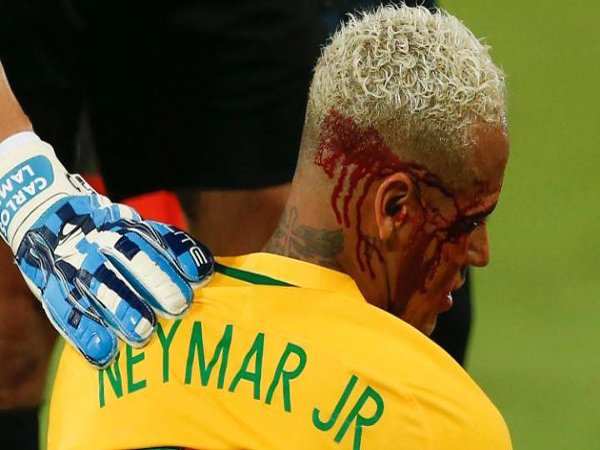 Berita Kualifikasi Piala Dunia 2018: Wajah Berdarah-darah Neymar warnai Kemenangan Brazil atas Bolivia