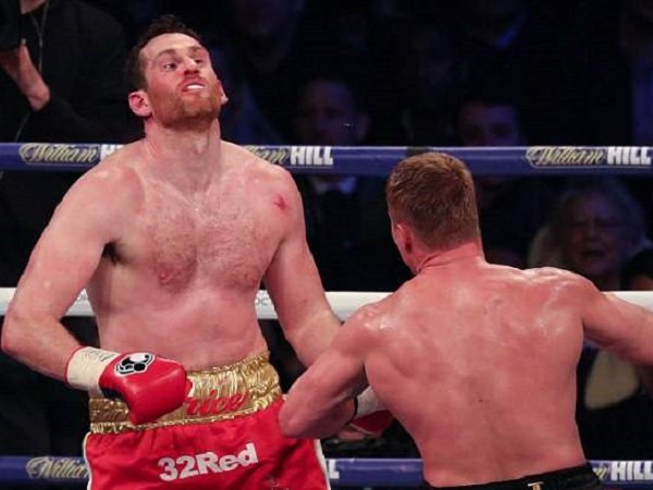 Dihajar Povetkin, Price Patah Hidung, 30 Jahitan di Mulut, 12 di Mata