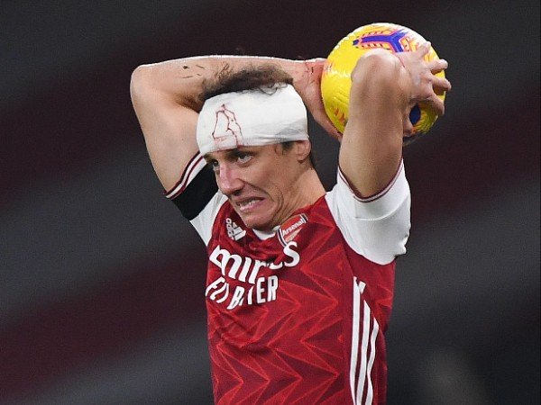 David Luiz harus memakai perban di kepala setelah berbenturan dengan Raul Jimenez