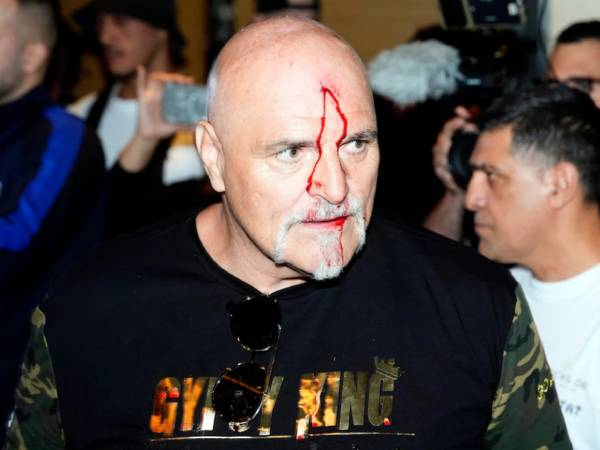 John Fury, ayah dari Tyson Fury, terlihat terluka di bagian kepala akibat menanduk salah satu anggota tim Oleksandr Usyk. (Foto: PA)