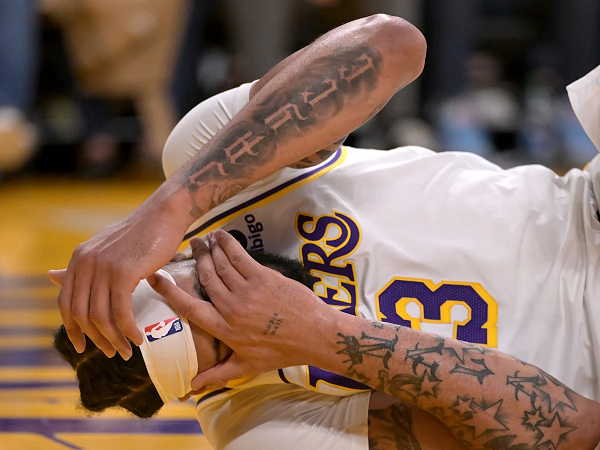 Anthony Davis alami cedera mata yang mengkhawatirkan.