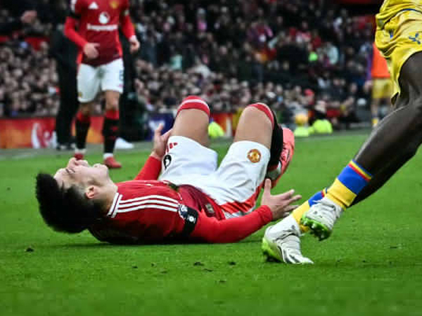 Manchester United Masih Tunggu Hasil Pemeriksaan Cedera Lisandro Martinez