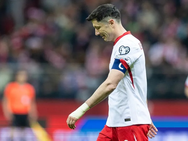 Robert Lewandowski Berharap Cederanya Tidak Parah