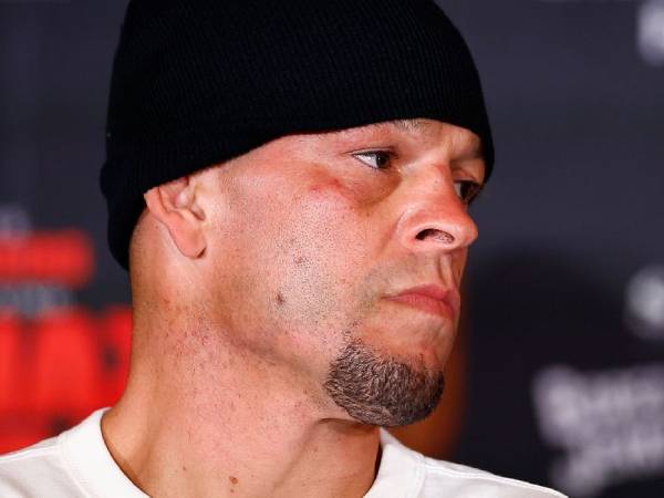 Nate Diaz merupakan salah satu figur paling terkenal dalam olahraga tarung. (Foto: AP)