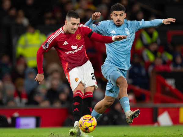Update Terbaru Kondisi Tim Jelang Laga Forest vs United di Premier League