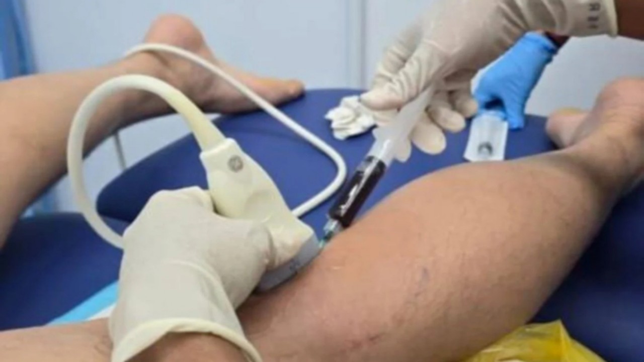 Tee Kai Wun Dikabarkan Langsung Pergi ke Rumah Sakit Pasca Kalah Dari Sabar/Reza