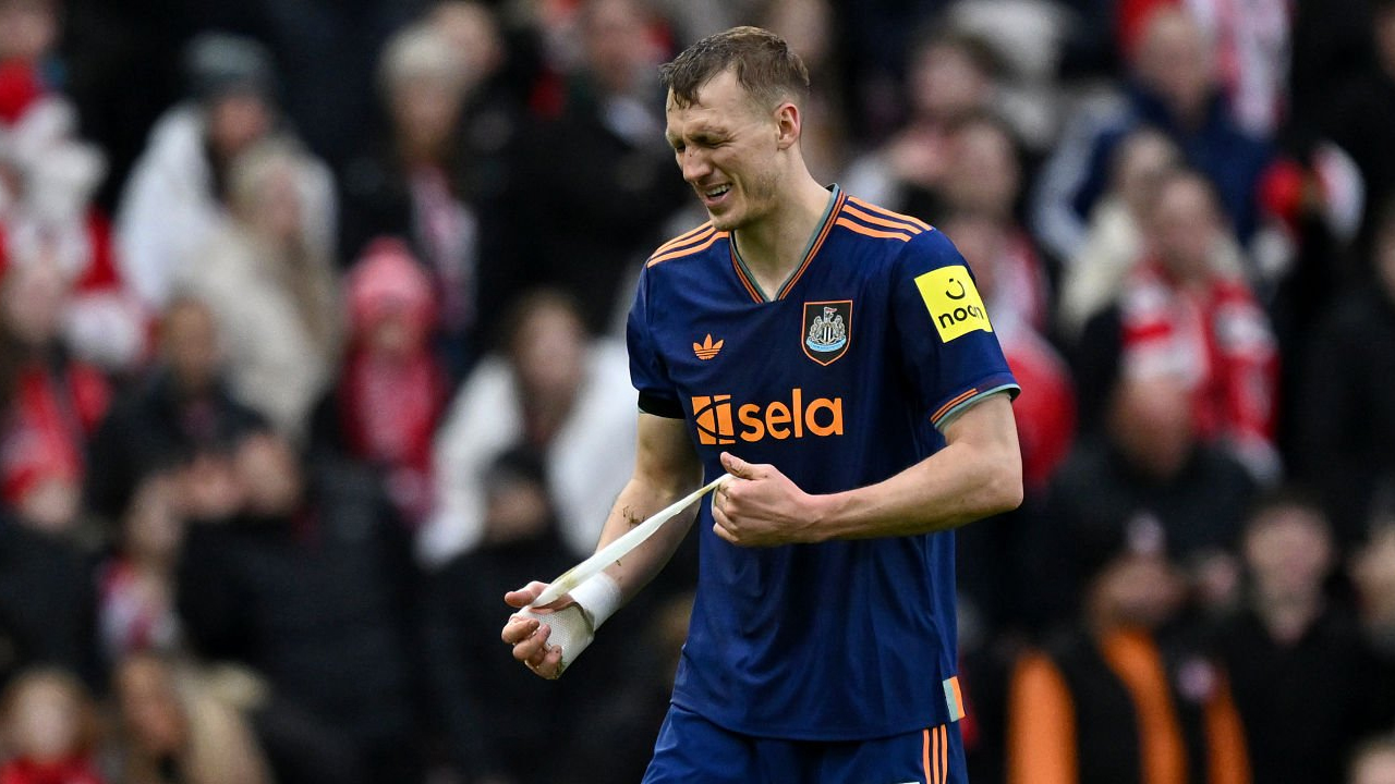Kekalahan Derbi Newcastle Diwarnai Cedera, Dan Burn Patah Tulang Rusuk