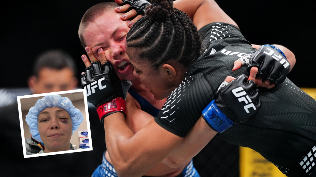 Rose Namajunas Jalani Operasi Mata Usai Alami “Eye Poke” di UFC 324