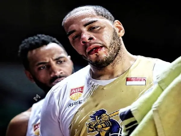 Brian Williams Klaim Jadi Korban Ketidakadilan Wasit ABL