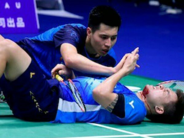 Cerita Teo Ee Yi tentang Insiden Berdarah di Piala Sudirman 2019