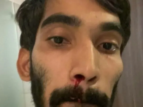 BWF Buka Suara Terkait Insiden Mimisan Kidambi Srikanth Saat Tes Usap PCR