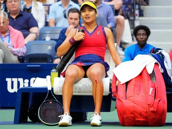 Emma Raducanu tak langgar aturan di final US Open 2021 ketika berdarah