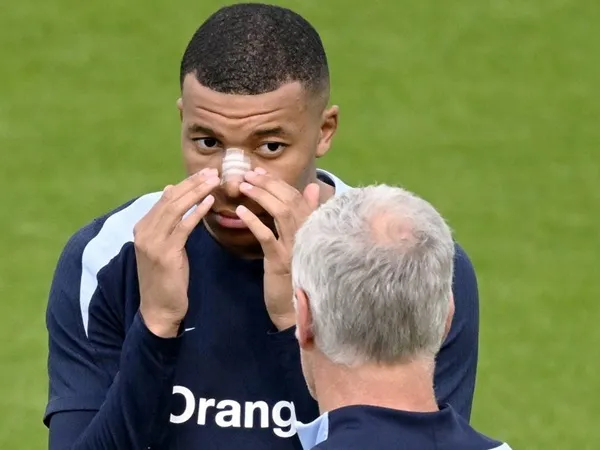 Kylian Mbappe Bisa Saja Absen Selama 4-5 Pekan