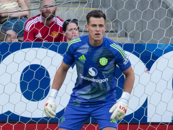 Radek Vitek Kecewa dengan Kekalahan MU di Markas Rosenborg