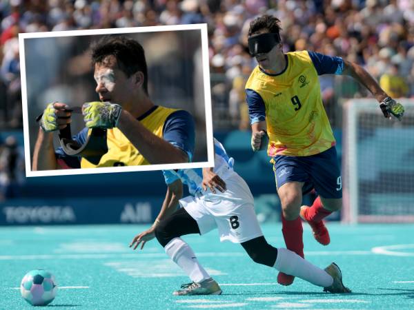 Jhon Gonzalez Bangga Dikenal Sebagai "Falcao Buta Dari Kolombia"