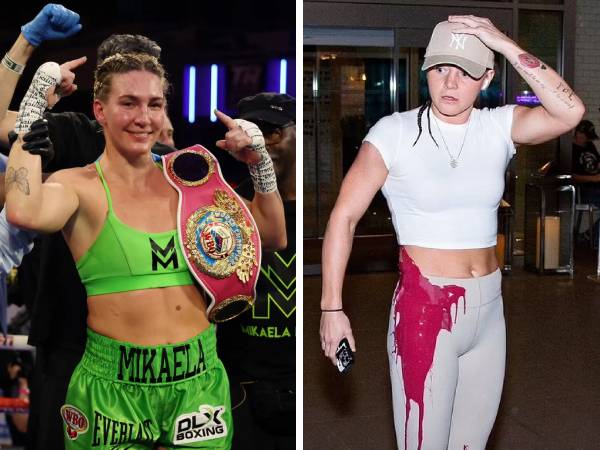 Sandy Ryan Tuduh Kubu Mikaela Mayer Dalangi “Serangan Cat”