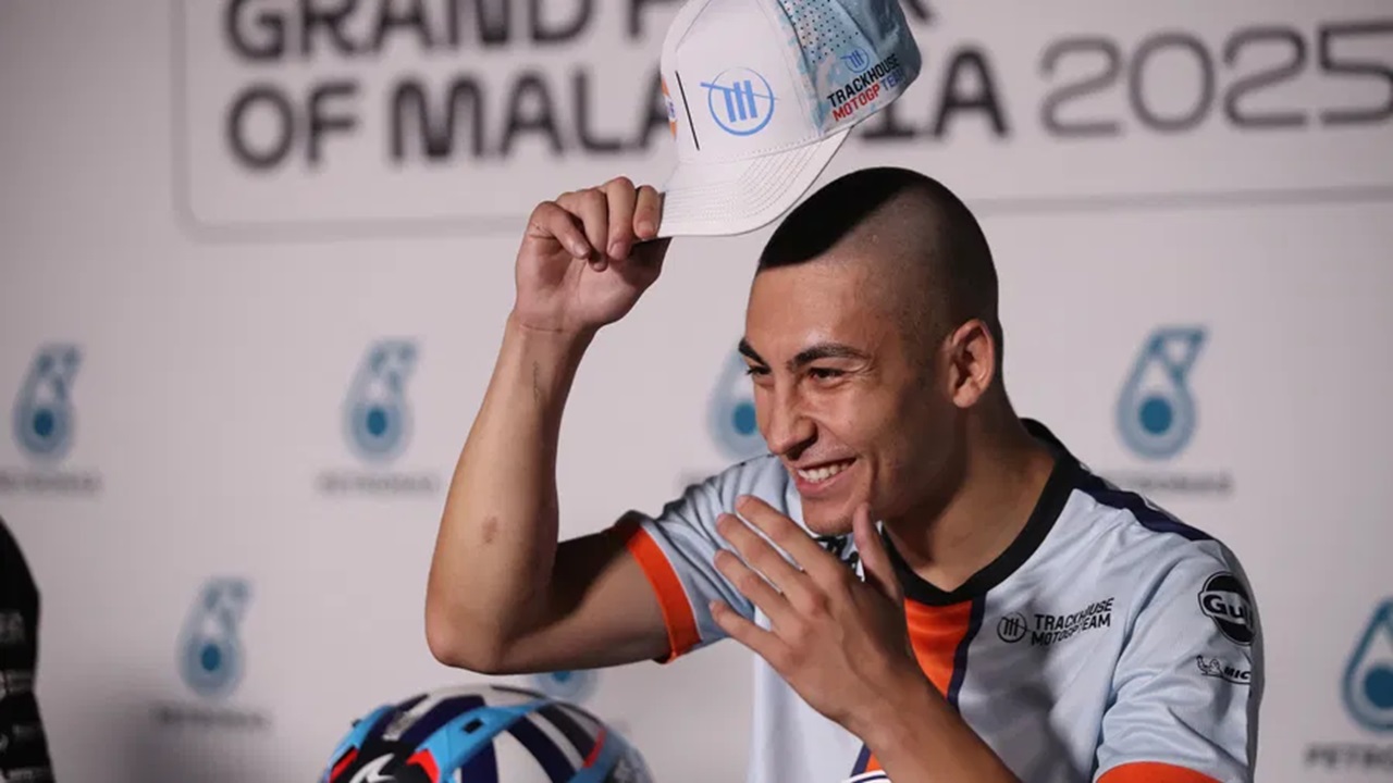 Raul Fernandez Terpaksa Mencukur Rambut hingga Botak