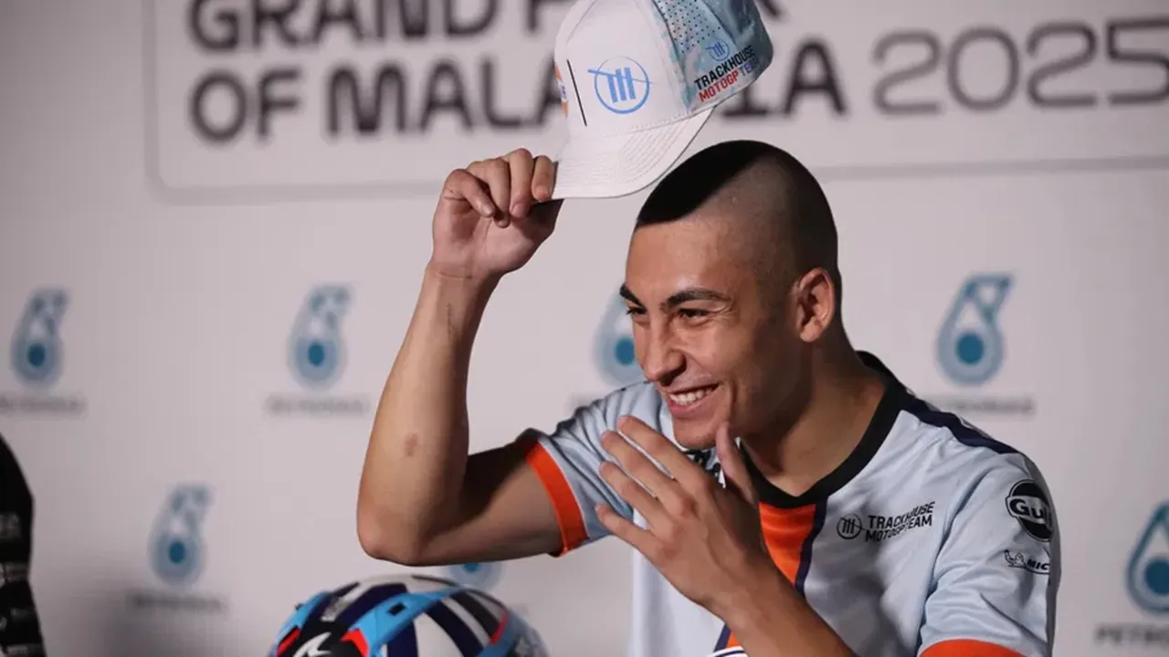 Raul Fernandez Terpaksa Mencukur Rambut hingga Botak