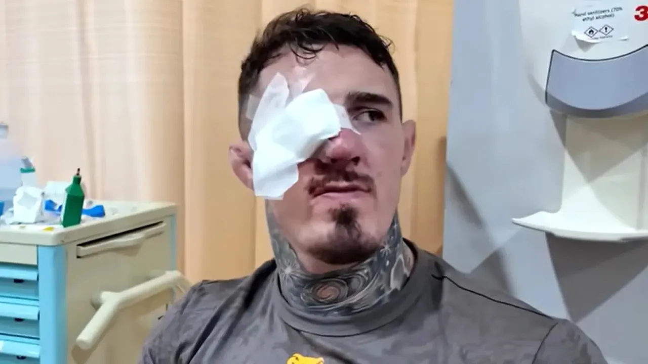 Tom Aspinall Dirawat di Rumah Sakit Setelah Cedera Mata di UFC 321