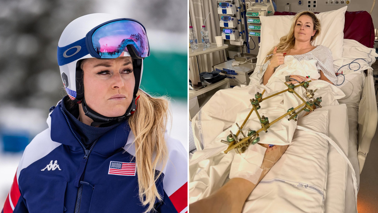 Lindsey Vonn Jalani Operasi Ketiga Usai Cedera Parah di Olimpiade 2026