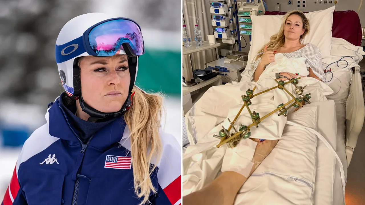 Lindsey Vonn tampak berbaring di ranjang rumah sakit dengan rangka logam menopang kakinya sambil memberikan isyarat jempol. (Foto: AP)