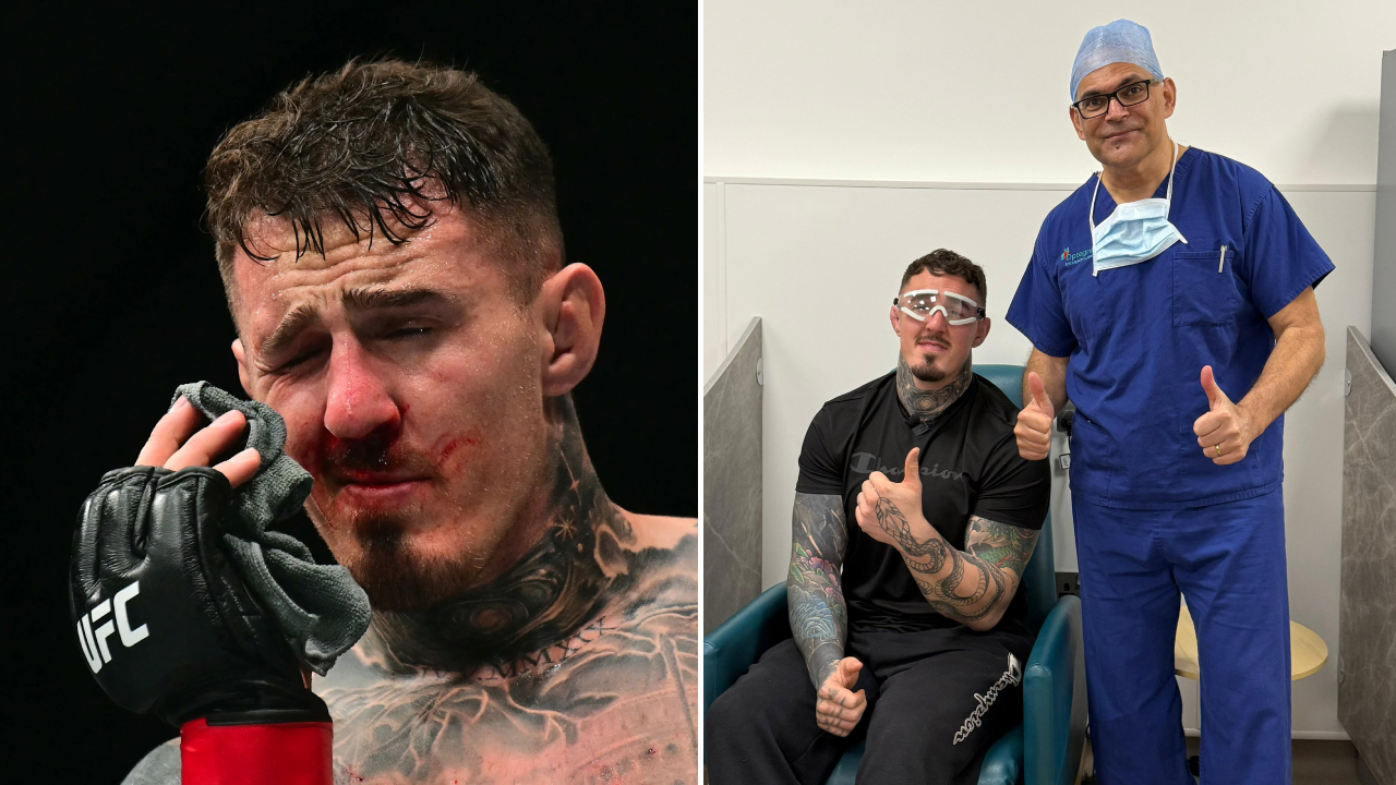Tom Aspinall Jalani Operasi Kedua Mata Usai Insiden Eye Poke di UFC 321