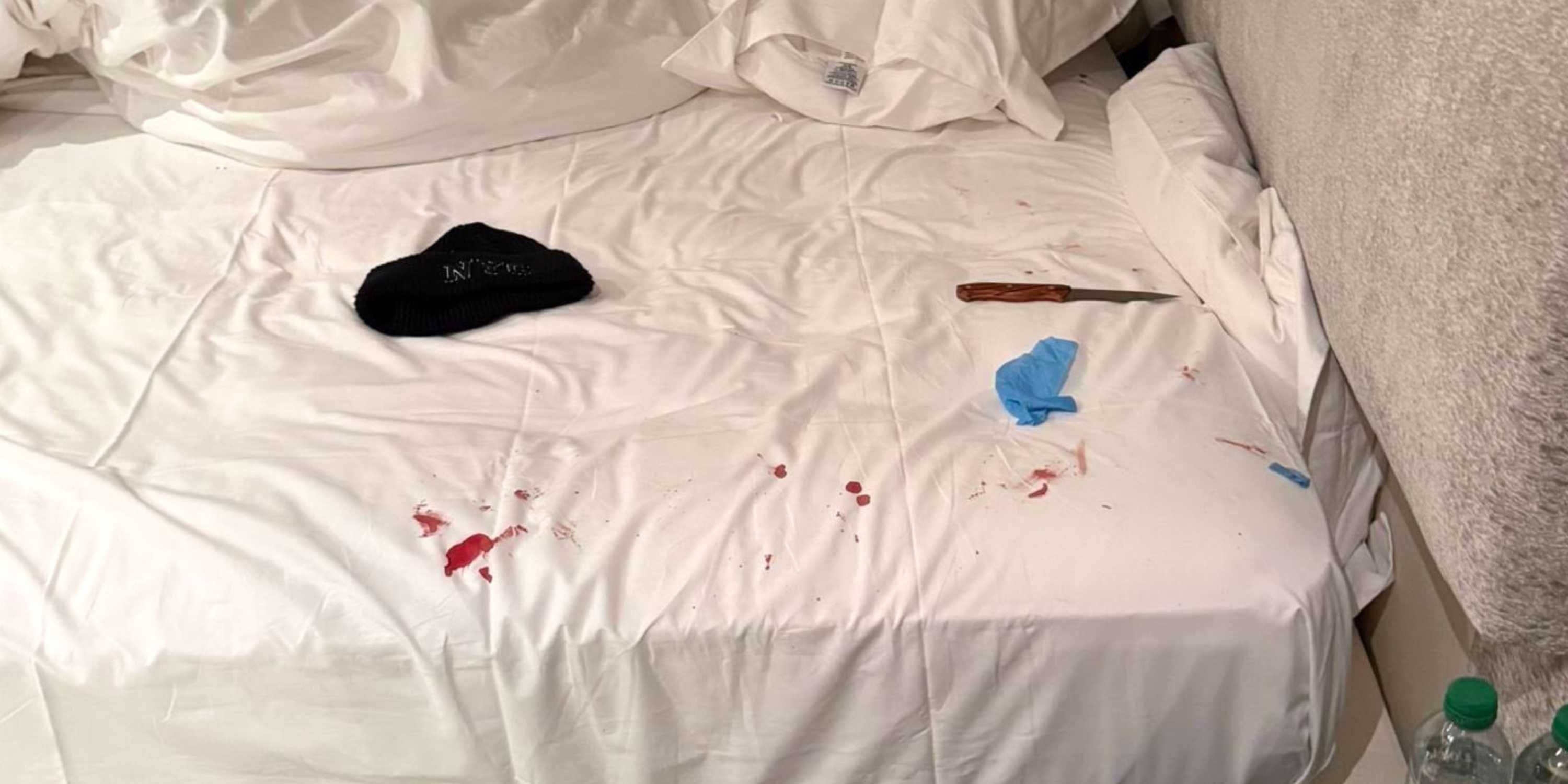 Mantan Pemilik Klub Liga Inggris Luka Parah Akibat Penusukan di Rumah