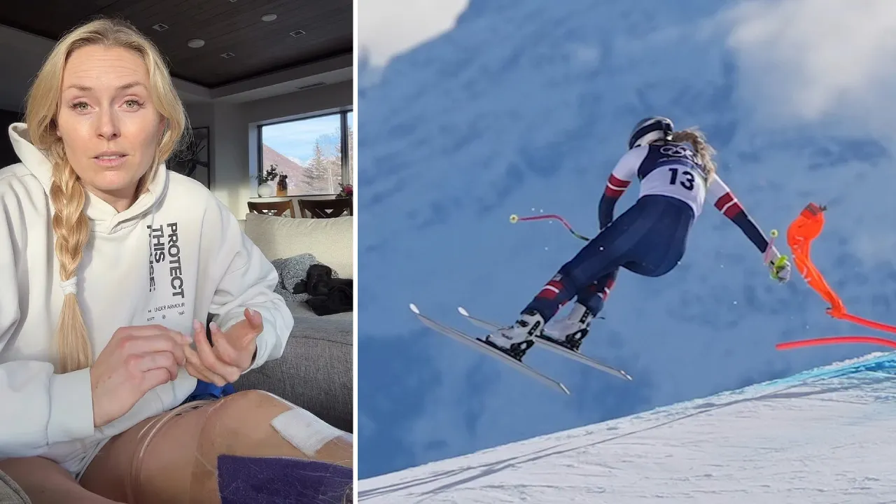 Lindsey Vonn Ungkap Operasi Selamatkan Kaki Kirinya Dari Amputasi