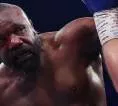Bukan Wilder, Ini Petinju dengan Pukulan Terkeras Versi Derek Chisora