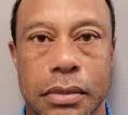 Hakim Izinkan Tiger Woods Jalani Perawatan Intensif di Luar Amerika Serikat