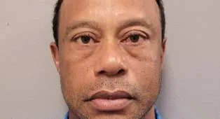 Hakim Izinkan Tiger Woods Jalani Perawatan Intensif di Luar Amerika Serikat