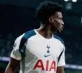 Cedera Winger Andalan Tottenham Belum Pulih Perlu Tindakan Operasi
