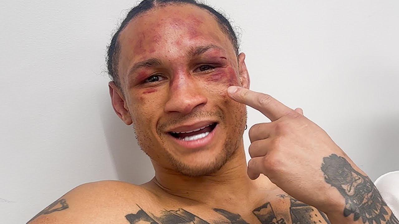 Regis Prograis Tutup Karier Setelah Duel Lawan Benn
