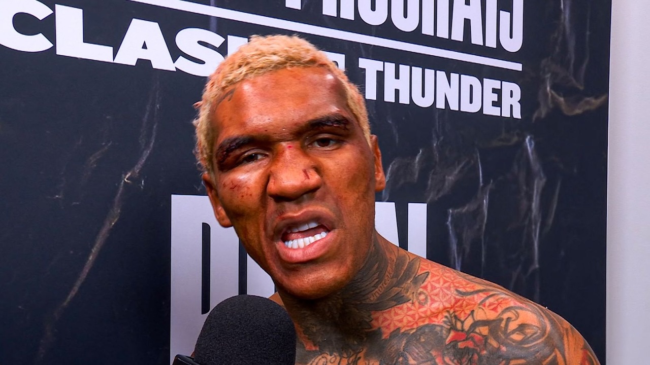 Menang Dominan Lawan Prograis, Conor Benn Tetap Dikritik Eddie Hearn