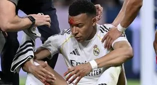 Real Madrid Diterpa Kabar Cedera dan Skorsing Jelang Lawan Bayern Munich