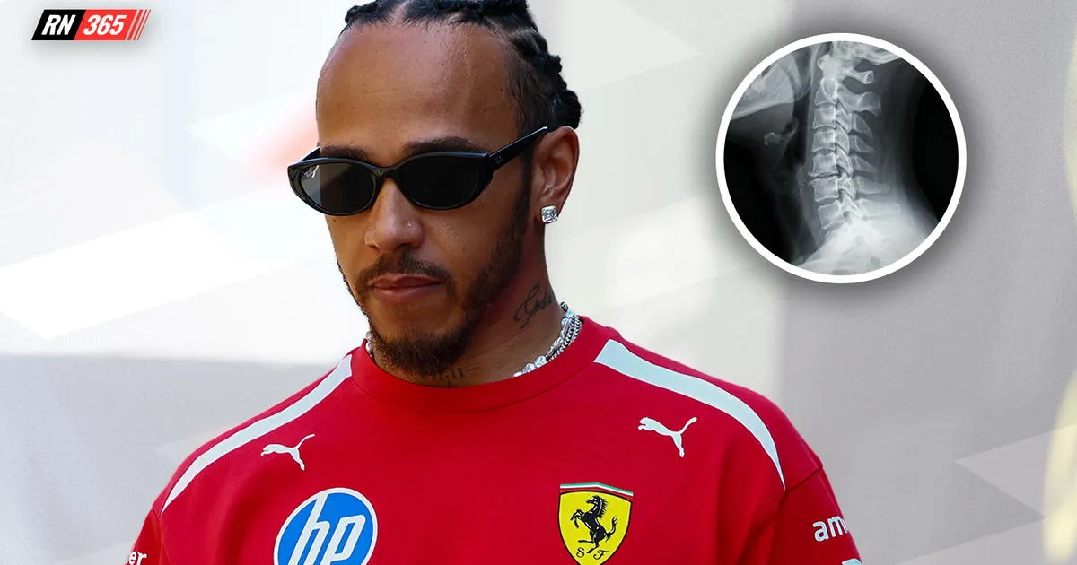 Lewis Hamilton Ungkap Cedera, Mercedes Terapkan Team Orders - sumber: (racingnews365)