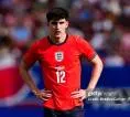 Matthias Jaissle Pastikan Tino Livramento Absen Lawan Liverpool