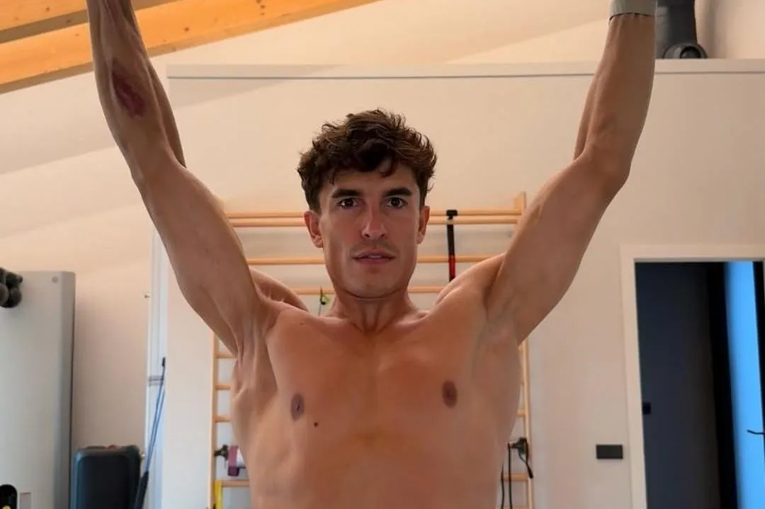 Marc Marquez Ungkap Kondisi Mengejutkan Lengan Kanannya - sumber: (motorsport)