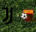 Prediksi Juventus vs AC Milan, 07 September 2026 Serie A