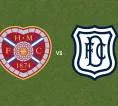 Prediksi Hearts vs Dundee, 06 September 2026 Scottish Premiership