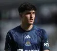 Matthias Jaissle Rem Kembalinya Tino Livramento