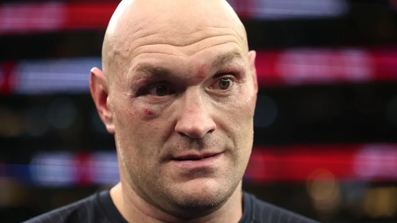 Tyson Fury