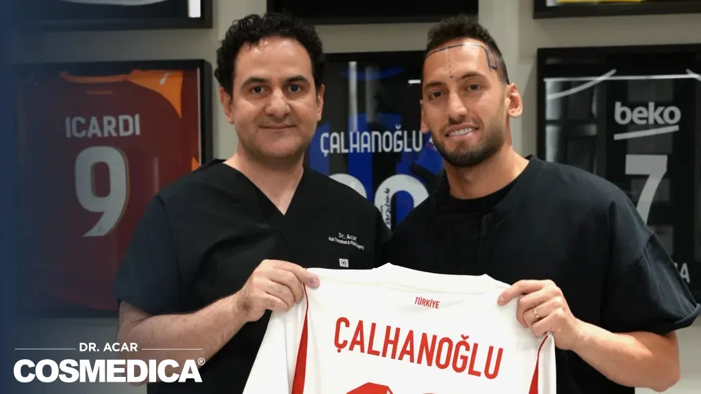 Hakan Çalhanoğlu Tetap Santai Hadapi Canda Rekan Setim Soal Transplantasi Rambut - sumber: (footballitalia)