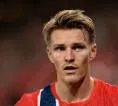 Kabar Cedera Terkini Arsenal: Odegaard, Havertz, Rice
