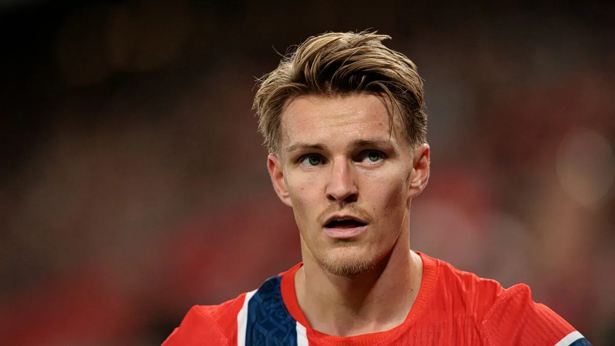 Kabar Cedera Terkini Arsenal: Odegaard, Havertz, Rice - sumber: (footballlondon)