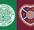 Statistik Kunci Jelang Laga Celtic vs Hearts di Scottish Premiership