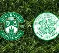Prediksi Hibernian vs Celtic, 25 Oktober 2026 Scottish Premiership