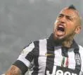 Arturo Vidal Sebut Serie A Masih Jadi Liga yang Berat